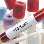 Confidential STD Testing Options: Private, Fast, and Reliable