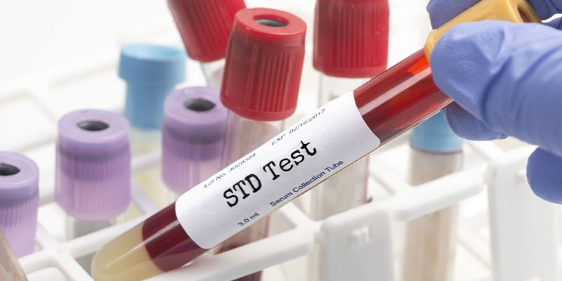 Confidential STD Testing Options: Private, Fast, and Reliable